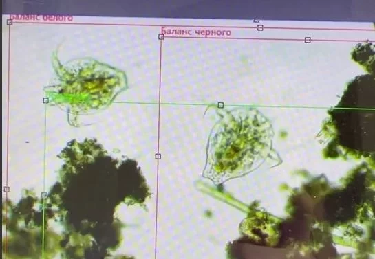 «Отпрыгнула от микроскопа». Врач из Екатеринбурга изучила воду из реки Исети: жуткое видео