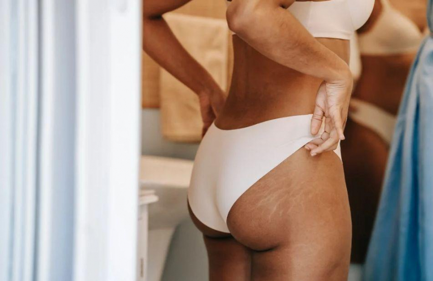 Гинеколог Дригинкина назвала стринги опасным для женского здоровья нижним бельем