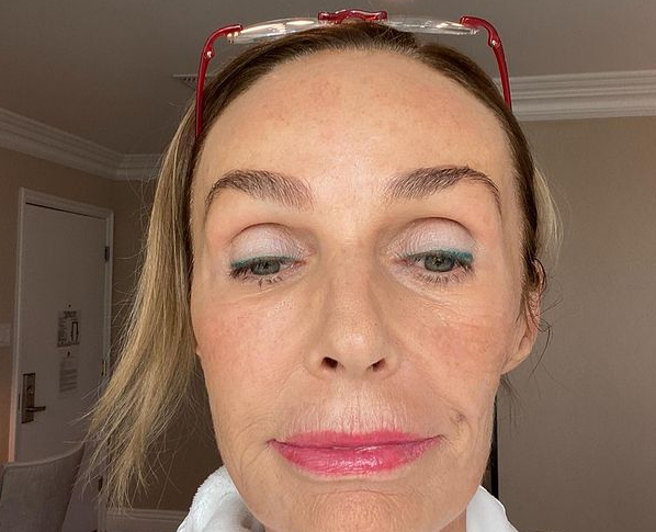 Что случилось с лицом Натальи Андрейченко