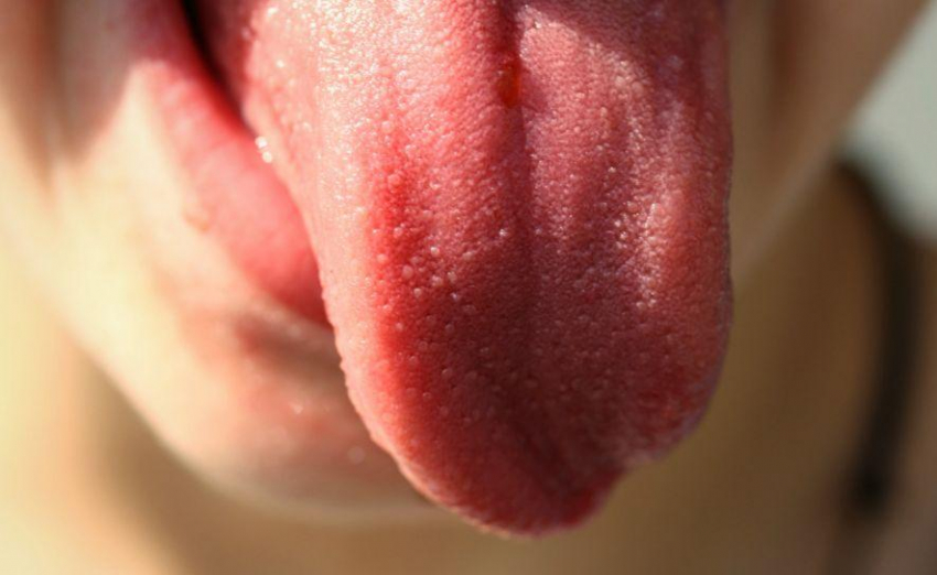 Терапевт Звонков рассказал о неприметном симптоме на языке, указывающем на цирроз печени