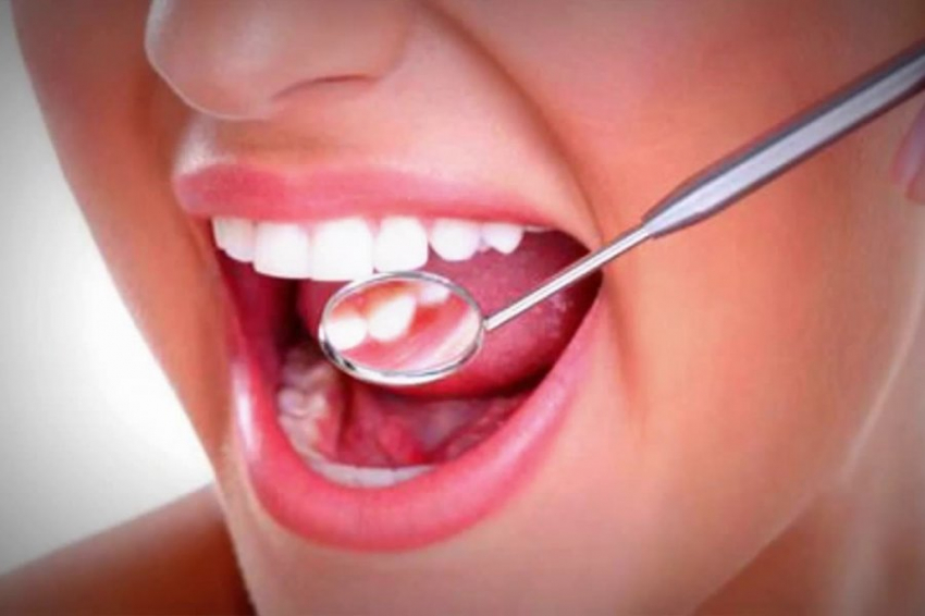 Врач Уланкина назвала три неочевидных признака рака ротовой полости