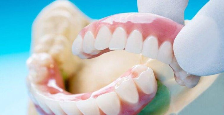 Имплантация или протезирование: Как выбрать оптимальное решение для восстановления зубов?