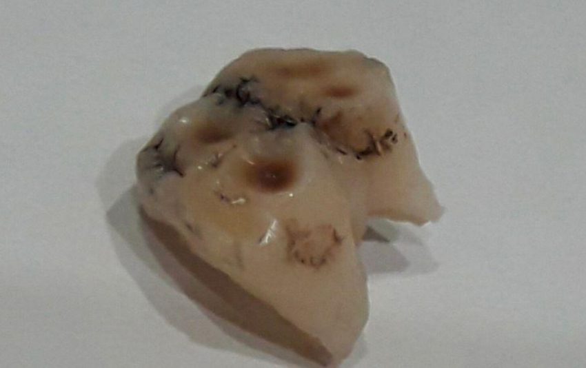 В Тюменской области женщина нашла зуб в магазинном холодце