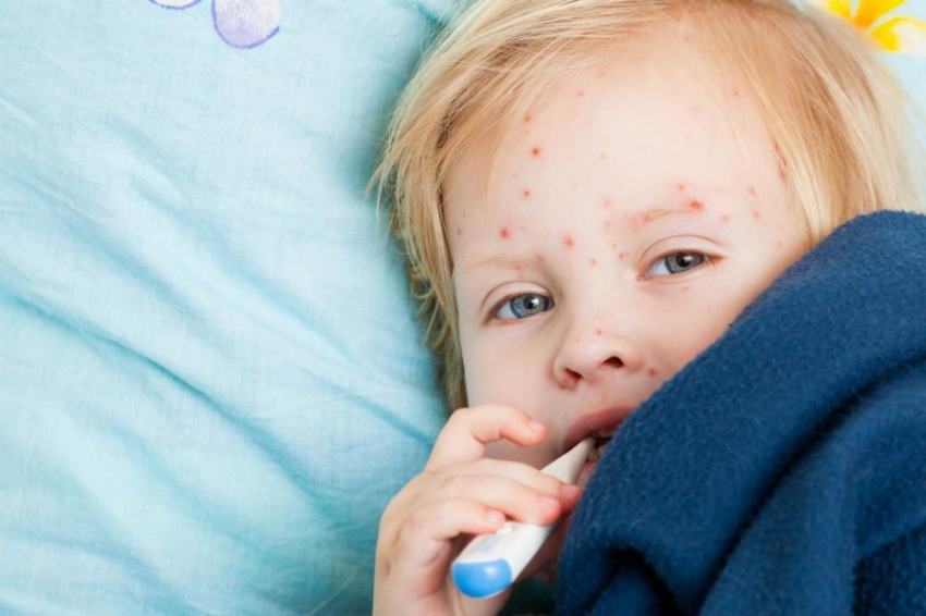 В Пензенской области зафиксирована вспышка кори