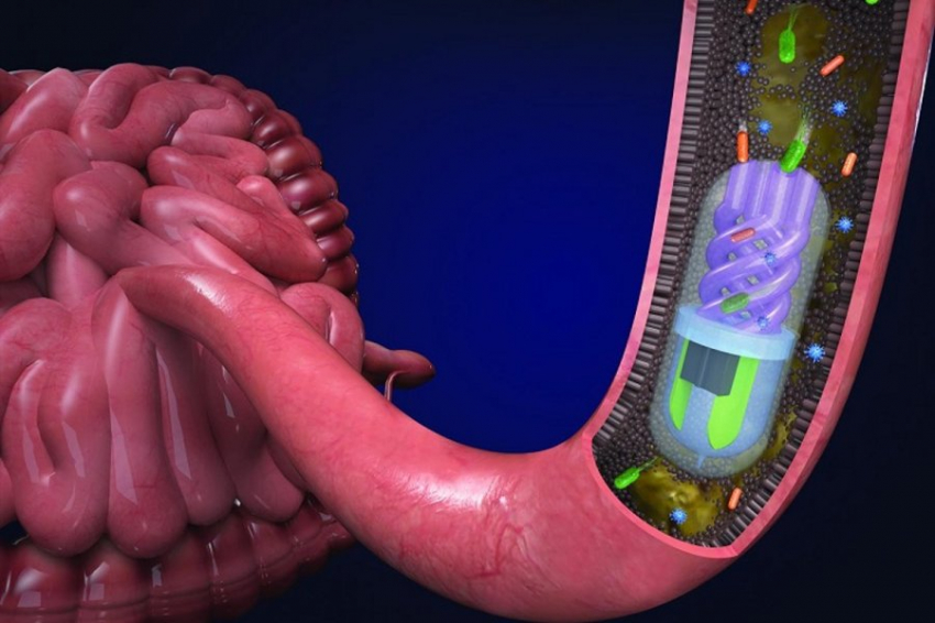 «Умная пилюля» станет переломным моментом в диагностике и лечении заболеваний кишечника у человека