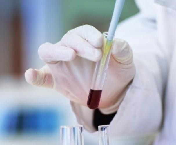 ELife: Учёные изучили, как цинк снижает риск диабета второго типа