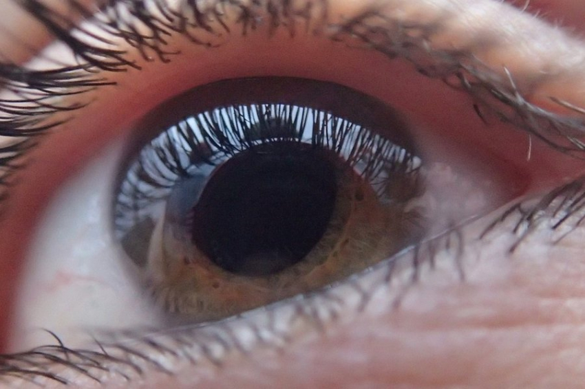 Научиться модифицировать ген глаукомы, учёные смогут через 10—20 лет