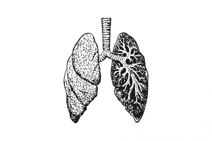В РФ разработали методику прогнозирования смертности при раке легкого