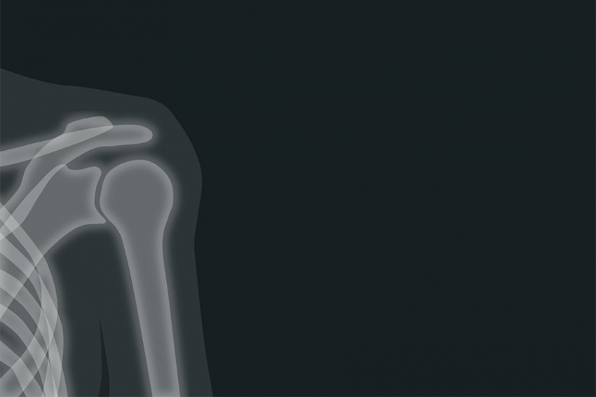 Живший 1,8 миллиона лет назад загадочный гоминид мог быть размером с современного человека