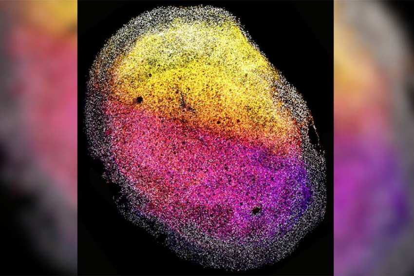 Ученые впервые вырастили «мини-мозги» из ткани головного мозга человеческого плода