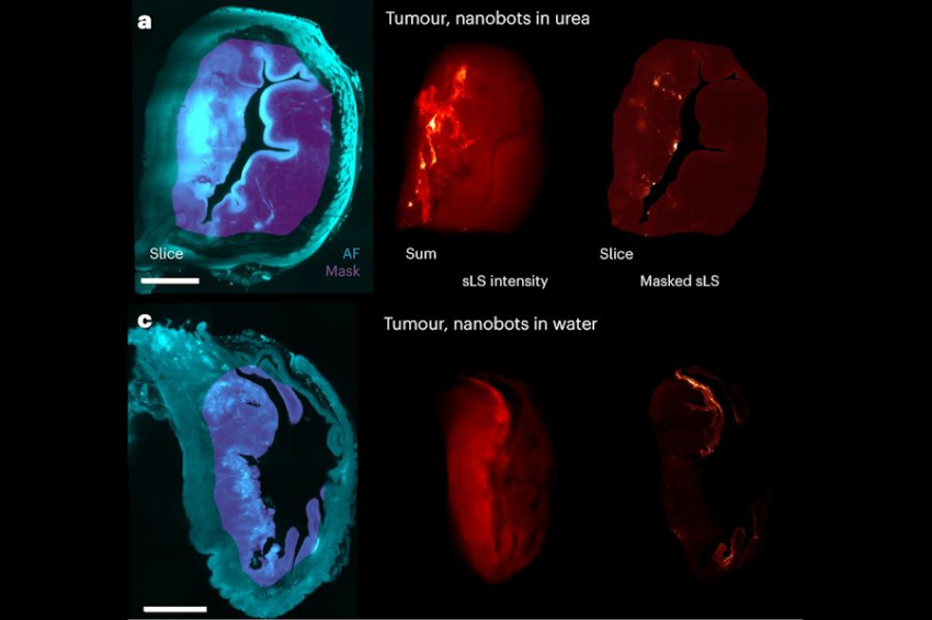 Лечение рака нанороботами уменьшило размер опухоли на 90%