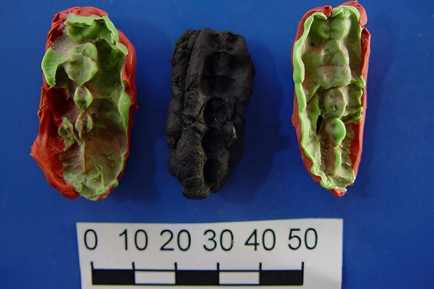 Анализ жеванного березового дегтя выявил плохое здоровье полости рта в эпоху мезолита