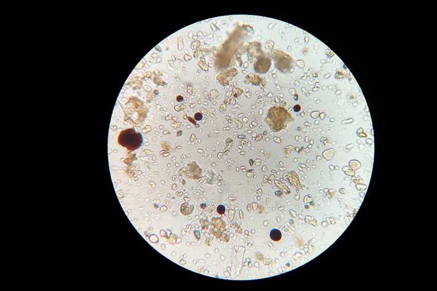 Nature Microbiology: взрывные бактерии-камикадзе жертвуют собой в борьбе с патогенными бактериями