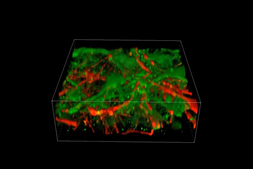 Ученые впервые напечатали на 3D-принтере функциональную ткань человеческого мозга