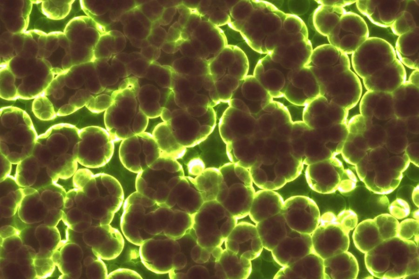 Ученые выявили, как микробная сеть влияет на разложение трупов