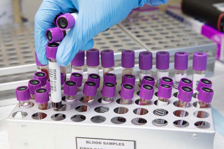 Выяснено, обладатели какой группы крови созданы для роскошной жизни