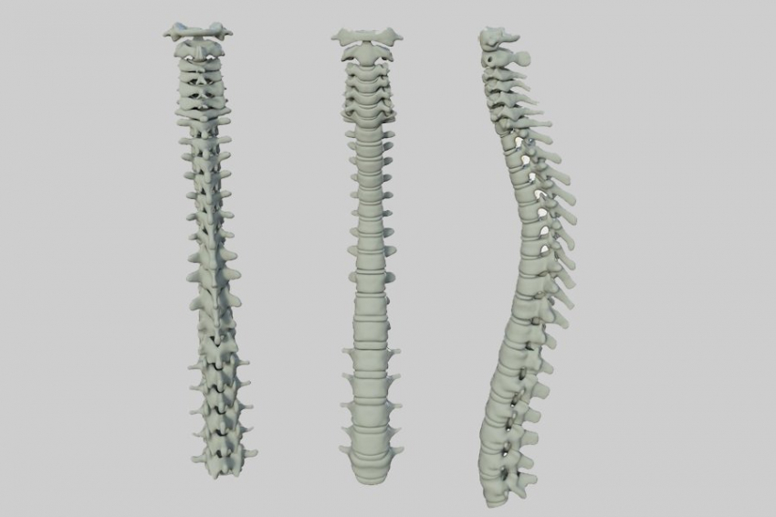 Учёные РФ разработали самообучающийся спинной протез