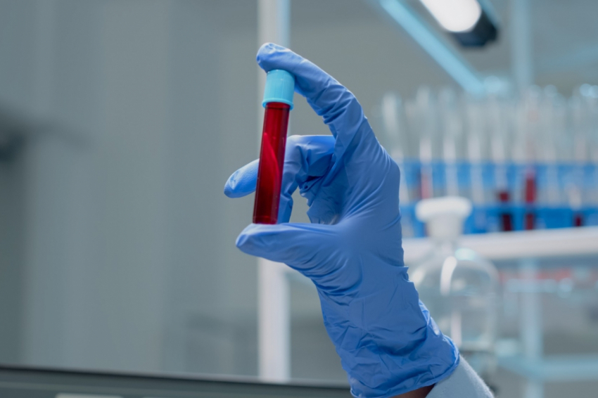 Группа крови всё расскажет о вас: Кто медленно стареет, а кто — встретит старость в своем уме — ученые все рассказали