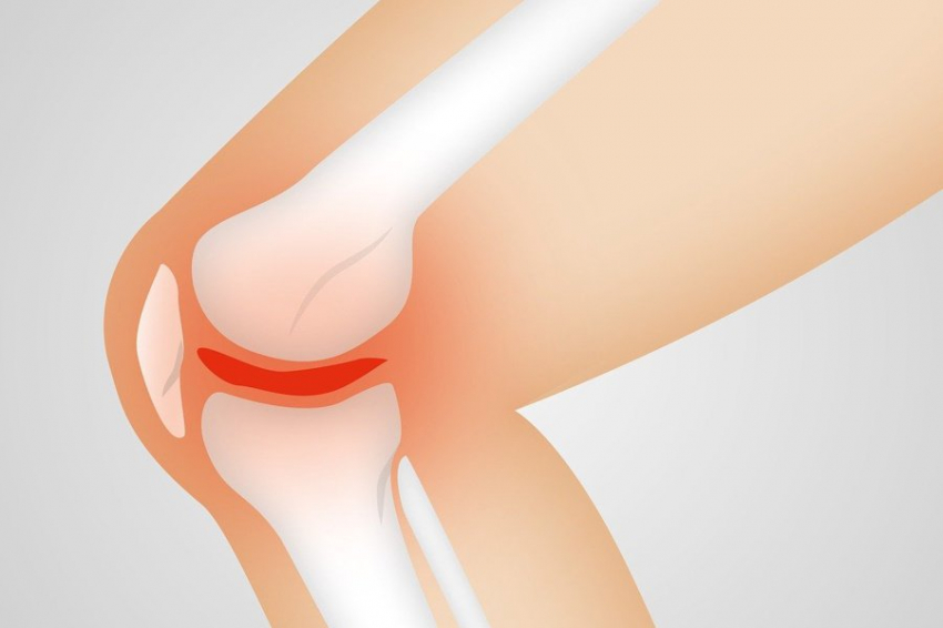 Пептиды и гиалуроновая кислота восстановили хрящ в коленных суставах