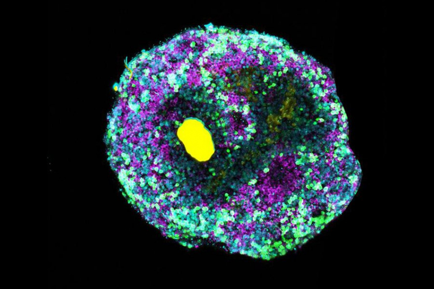 Новая технология молекулярной инженерии позволяет создавать сложные органоиды
