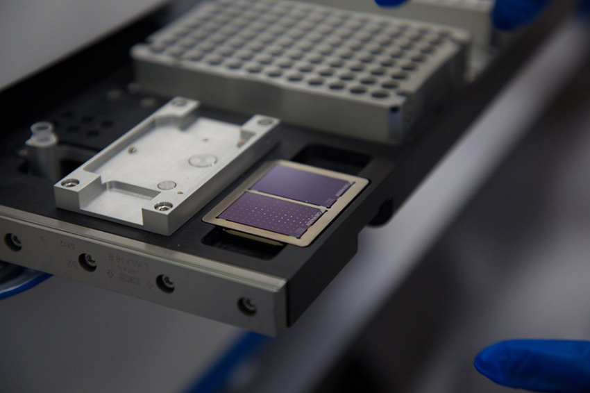 Мутация белка-регулятора увеличила риск развития сахарного диабета у людей с избыточным весом или ожирением 