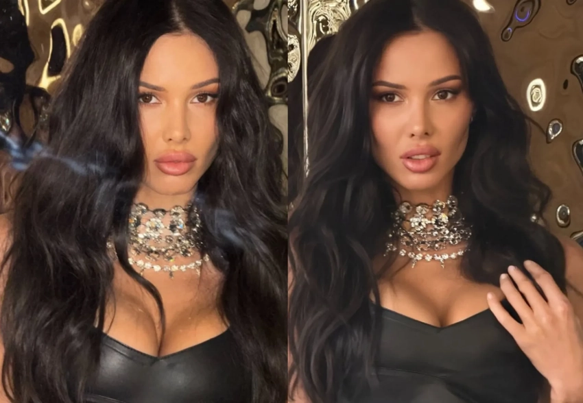 "Филлеры или рино". Анастасию Решетову снова сравнили с Бьянкой Цензори после новой фотосессии