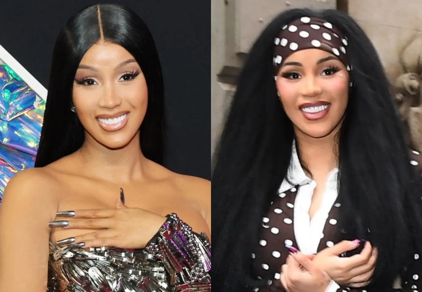 Карди Би заподозрили в новой пластической операции